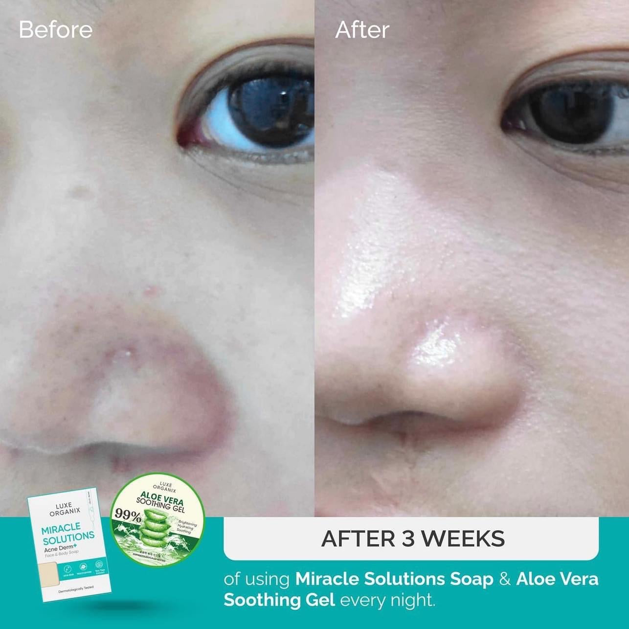 Luxe Organix - Miracle Solutions Soap