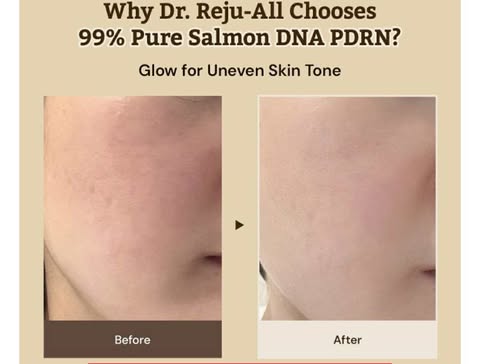 DR REJU-ALL ADVANCED PDRN REJUVENATING CREAM