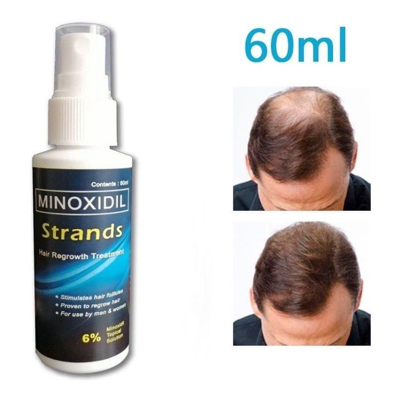 Strands Minoxidil 6% Ultimate for Hairgrow 60ml (Hair Grower, Beard Grower, Anti Hair Loss,